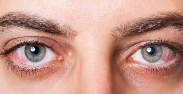 کار هایی که خشکی چشم را بیشتر می کند